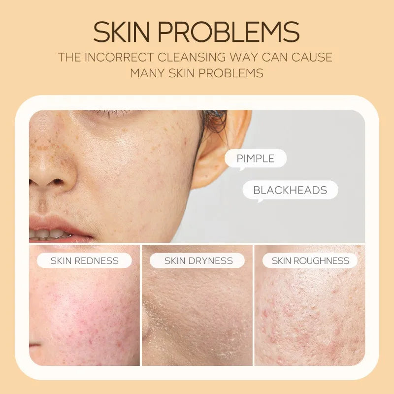 120ml Vitamin C Cleansing Mousse Facial Care Cleansing Pore Brightening Skin Tone Shrinking Pore Facial cleanser Skin care