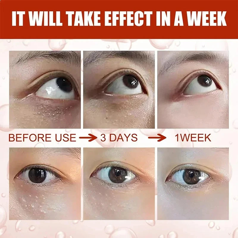 Eye Cream Anti-Puffiness Anti Inflammatory Reduce Dark Circles Fade Fine Lines Repair