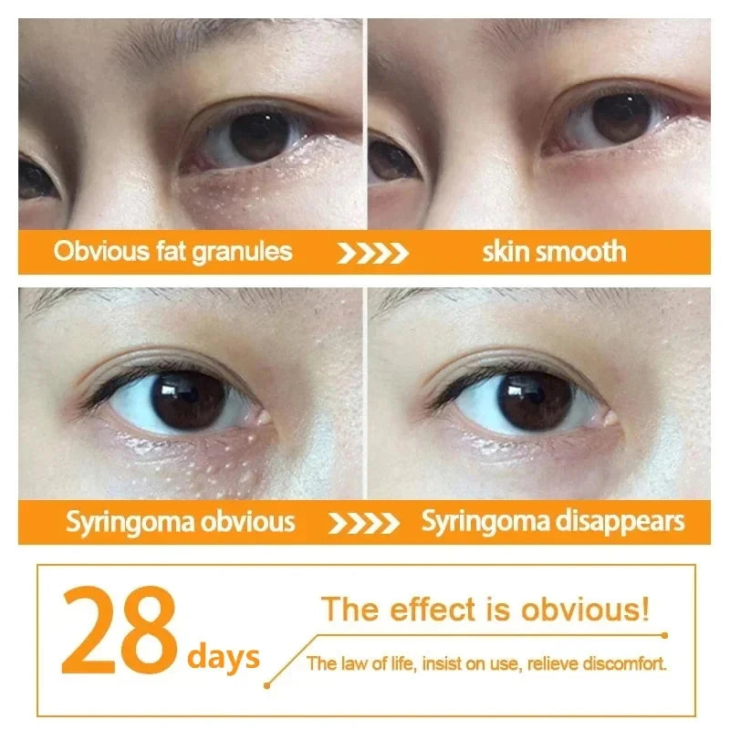Eye Cream Anti-Puffiness Anti Inflammatory Reduce Dark Circles Fade Fine Lines Repair