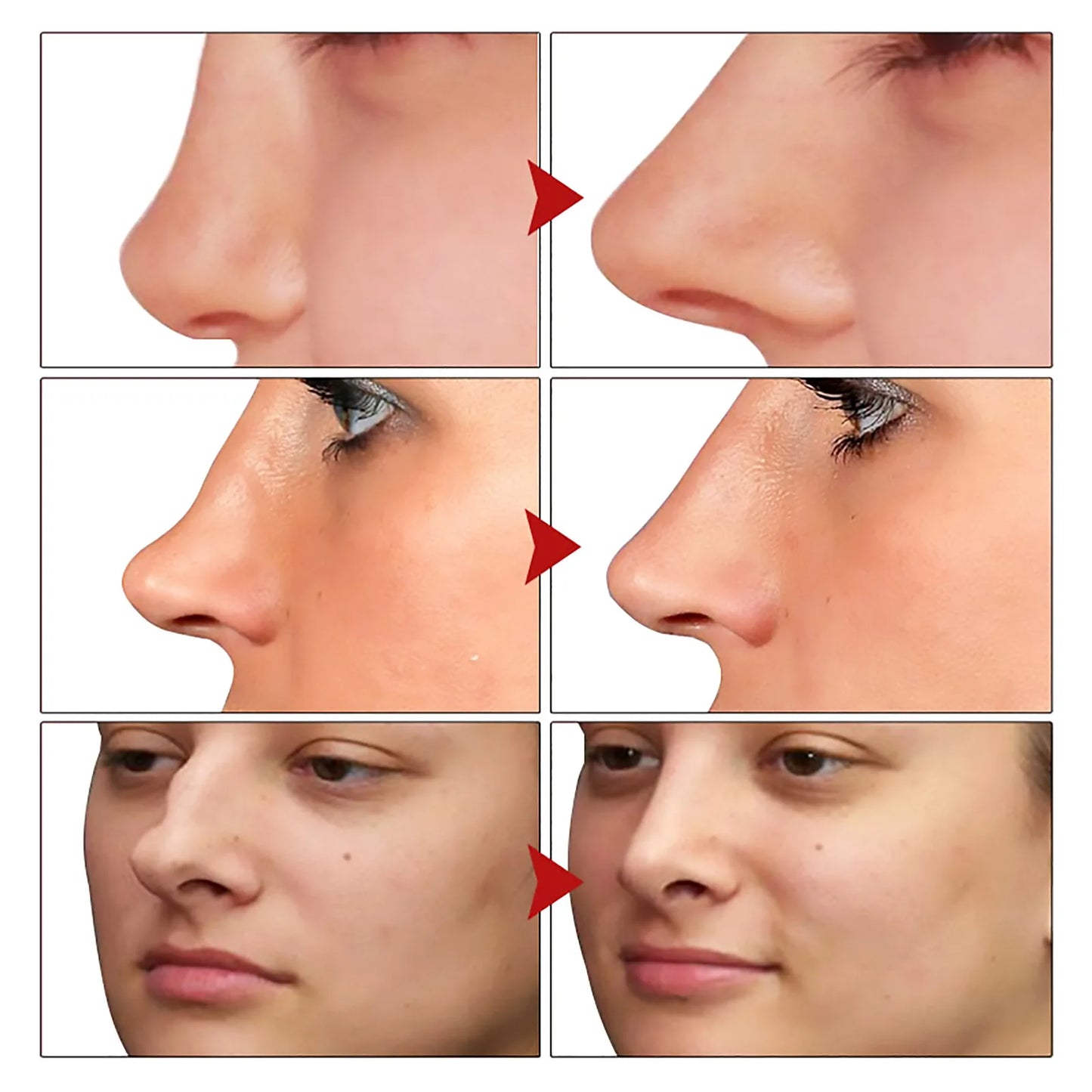Nose Lifting Essential Oil