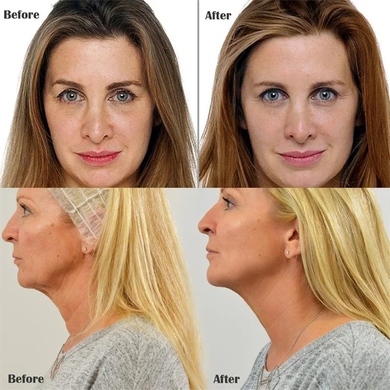 Anti-aging Collagen Thread Instant Lifting Wrinkle Remover