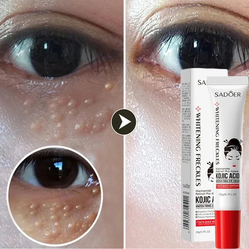Eye Cream Anti-Puffiness Anti Inflammatory Reduce Dark Circles Fade Fine Lines Repair