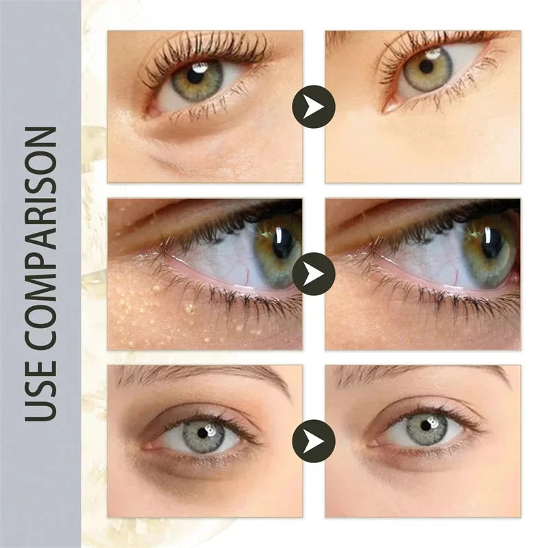 Eye Cream Anti-Puffiness Anti Inflammatory Reduce Dark Circles Fade Fine Lines Repair