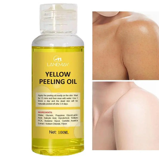 Yellow Peeling Oil Bleaching Dark Skin