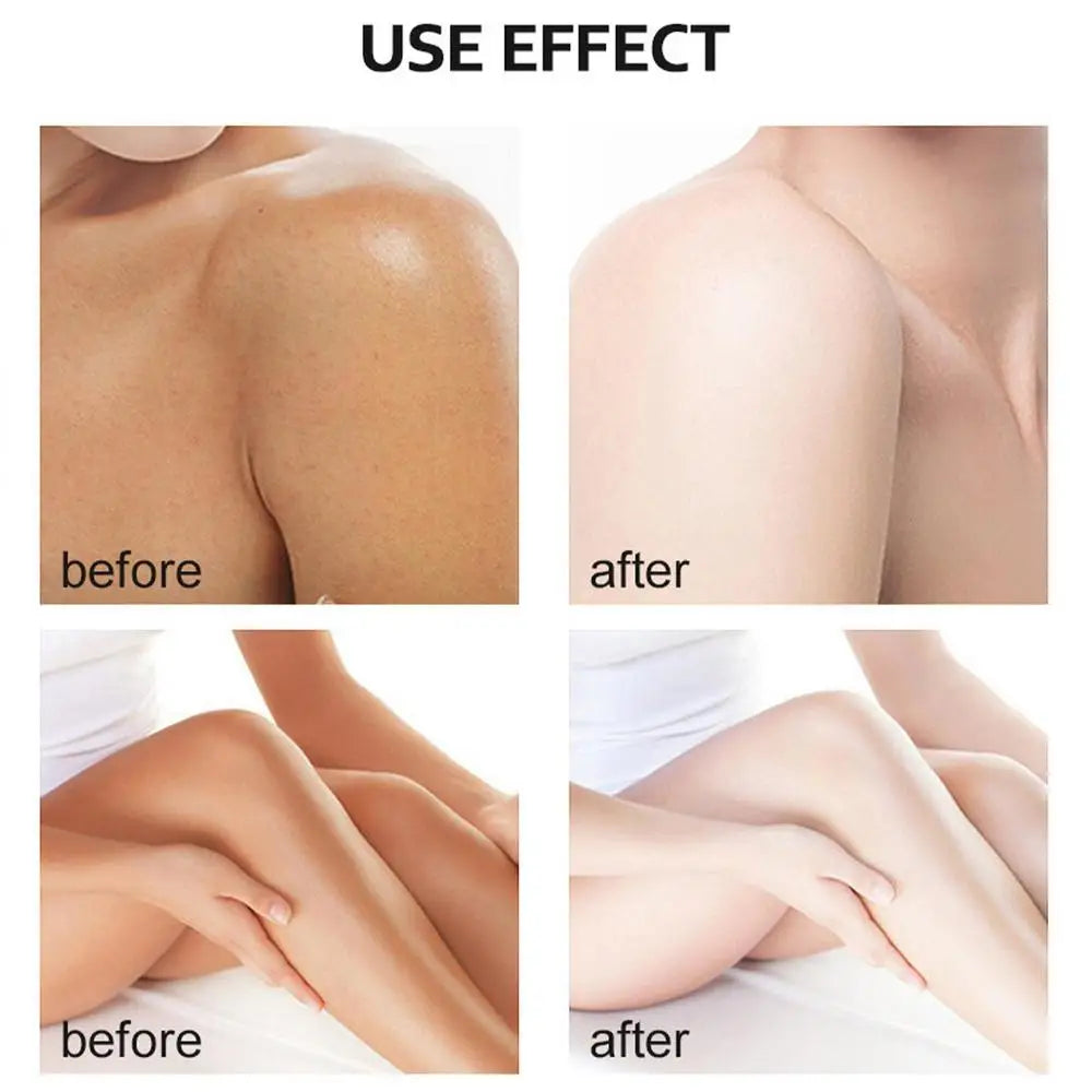 Yellow Peeling Oil Bleaching Dark Skin
