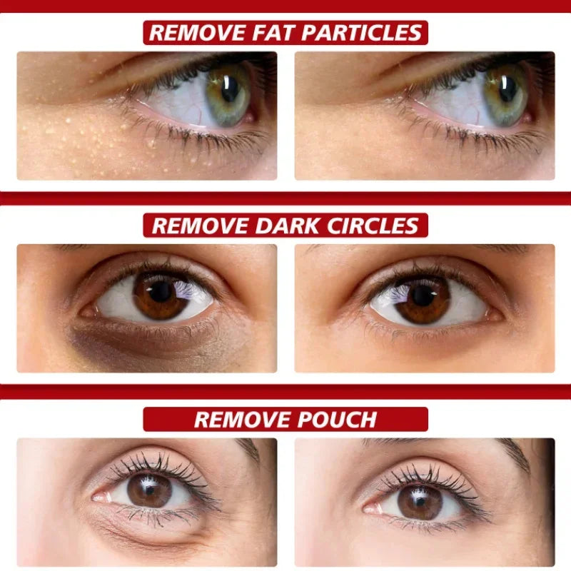 Eye Cream Anti-Puffiness Anti Inflammatory Reduce Dark Circles Fade Fine Lines Repair